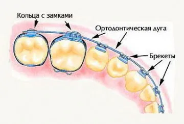 Корекция на захапка при кучета, кучешки захапка