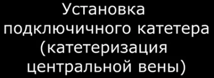 Установка имплантируемого кардіовертера-дефібрилятора (ІКД) (установка ІКД) Установка имплантируемого кардіовертера-дефібрилятора (ІКД)