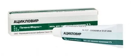 Як лікувати ячмінь на оці в домашніх умовах