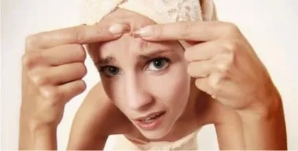 Hogyan lehet leküzdeni a pattanások az arcodon - egyszerű tipp, valamint egy női magazin
