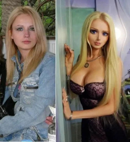 Валерія лукьянова фото до і після пластики (валерія лукьянова фото) Валерія лукьянова фото до і після пластики