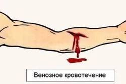 венозна кров