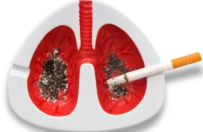 Lung karcinóma prognózisa a túlélés, a tünetek és a kezelés