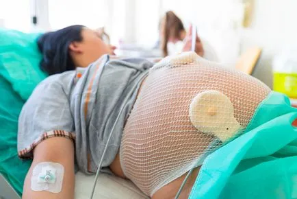 cezariene, înainte, în timpul, după - pe site-ul - Totul despre sarcină, naștere, alăptarea