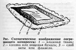 Compress burgonya köhögés