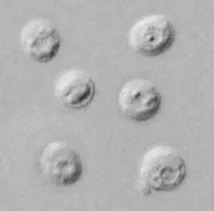 Cryptosporidium (Cryptosporidium)