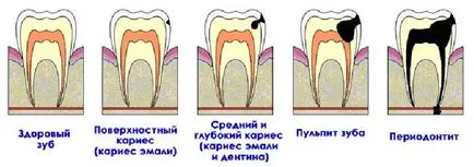 Лечение и възстановяване на зъбите
