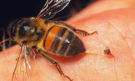 Prosztatagyulladás méhek leírás, módszerek, jellemzők