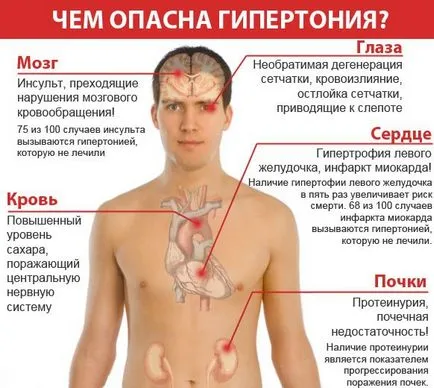 Tratarea apei hipertensiunii arteriale - tratament cardiac