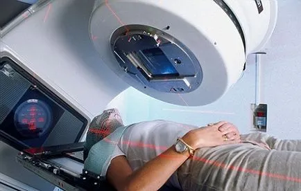 Radioterapie și diagnostic cistita post-tratament radiatii si caracteristici