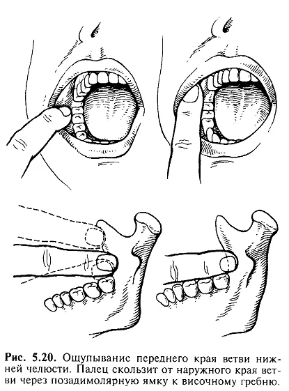 bloc Inferioare nervului alveolar - un portal dentar bun, portal dentare bun