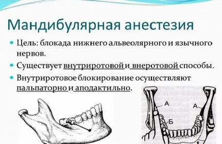 tehnica blocului nervului alveolar inferior al Berchet de stejari și alte metode verlotskomu