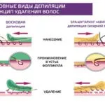 Як користуватися воском для депіляції плівковим, рідким і в гранулах (гранулах) Як користуватися воском для депіляції плівковим, рідким і в гранулах