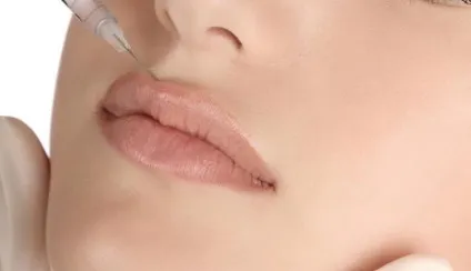Як підняти куточки губ сонячна леді (куточки) Як підняти куточки губ сонячна леді