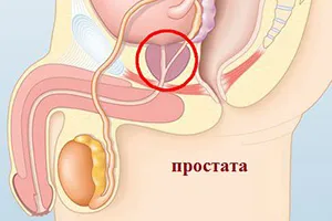 Масаж простати в домашніх умовах