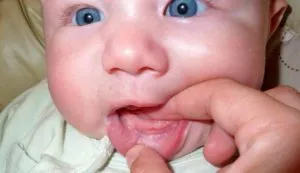 A szájpenész a szájába egy gyermek, mint kezelni, és a megelőzés eszköze