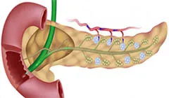 Elégtelensége a cardia a gyomor (cardia sphincter), hogy