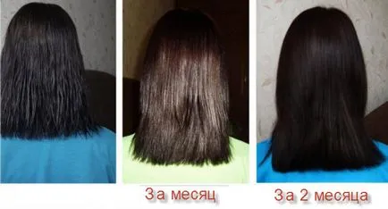 Нікотинова кислота для росту волосся