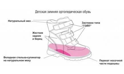 Orteke - детски ортопедични обувки триизмерна мрежа, показания, противопоказания