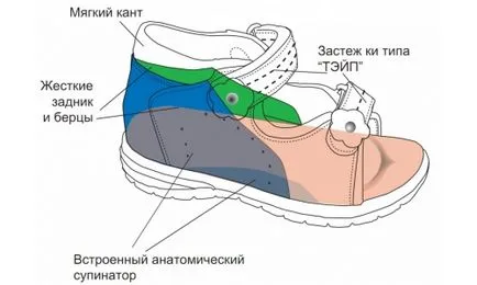 Orteke - gyermek ortopéd cipők dimenziós rácsot, javallatok, ellenjavallatok