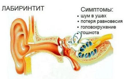 Otita medie - că este simptomele, cauzele si tratamentul