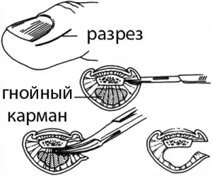 Престъпник и отношението му към народната медицина