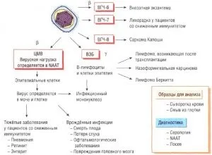 Хронічна цитомегаловірусна інфекція (цитомегаловірусна) Хронічна цитомегаловірусна інфекція