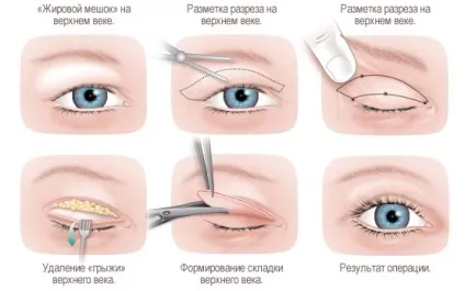 Погляд з Голлівуду чому особи зірок так спотворюються 300