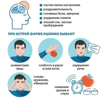 Хронічна ішемія головного мозку причини, симптоми, стадії, діагностика, лікування (головного) Хронічна ішемія головного мозку причини, симптоми, стадії, діагностика, лікування