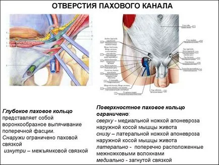 Ингвинална херния при жените - симптоми, лечение, профилактика