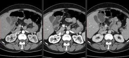 Pregătirea pentru CT abdominal cu contrast și fără