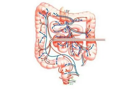 pregatirea intestinului pentru irigoscopie cum să