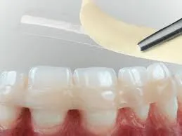 mobilitate dinte