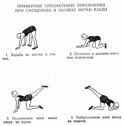 Загин матки і зачаття - які пози допоможуть завагітніти (матки) Загин матки і зачаття - які пози допоможуть завагітніти