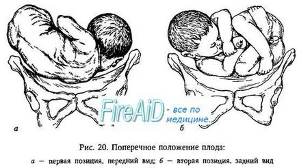 Фетална представяне (rraesentatio)