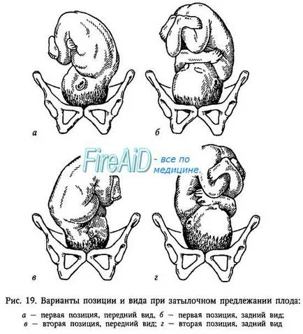 Фетална представяне (rraesentatio)