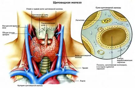 Ознаки раку щитовидної залози (стадія раку щитовидної) Ознаки раку щитовидної залози