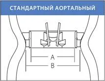 Митралната клапа протеза