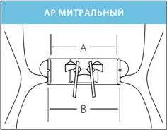 Митралната клапа протеза