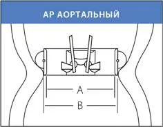 Митралната клапа протеза