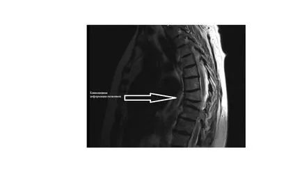 Megfejtése a mellüreg MRI