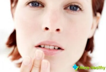 A seb a száj kezelést igényel antiszeptikumok