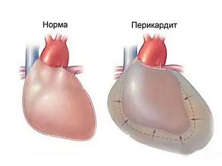 Симптоми и лечение на болестите при котки