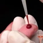 Печіння в грудній клітці