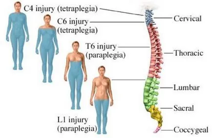 Spinalis shock fejlesztési mechanizmusok, tünetei és kezelése jellemzői