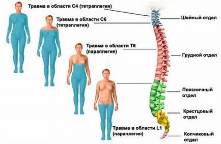 șoc spinării și mecanismul de dezvoltare sale cauze, simptome, patogeneza și fiziologie