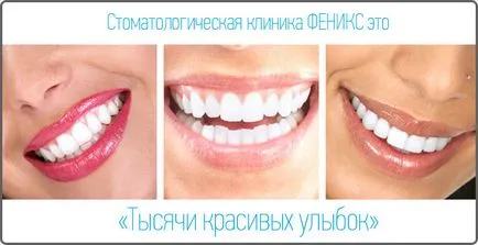 Dental Clinic Rosztovban, saját fogászati ​​klinika phoenix, szolgáltatások árának