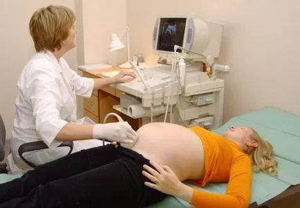 Третият ултразвук по време на бременност, когато в какъв период