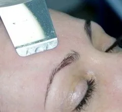 Ултразвуково почистване на лицето са противопоказания - хардуер козметология