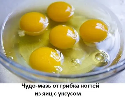 Оцет и яйце от гъбички на ноктите, на мястото на лекарите лечения Neumyvakina, Болотов,